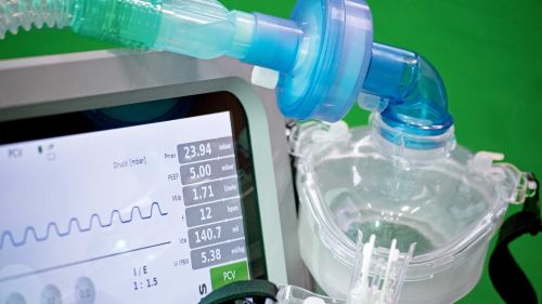 Ventilator display and filter